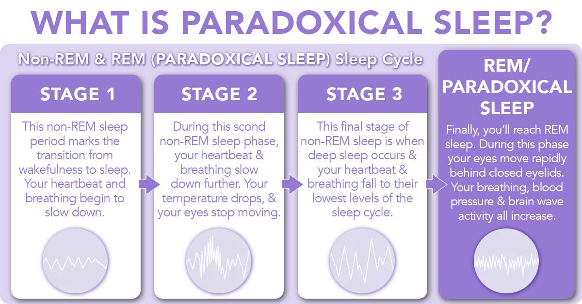 What Is Paradoxical Sleep 